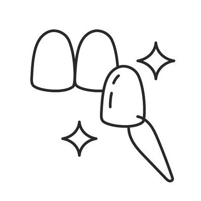 Facetten